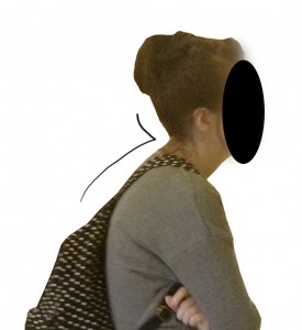 forward head posture